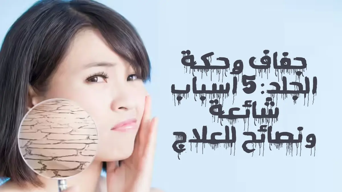 أسباب جفاف الجلد